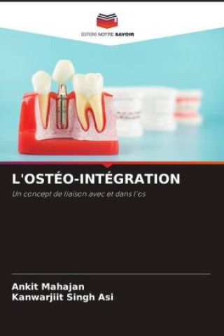 Knjiga L'OSTÉO-INTÉGRATION Kanwarjiit Singh Asi