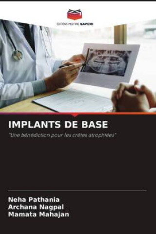 Knjiga IMPLANTS DE BASE Archana Nagpal