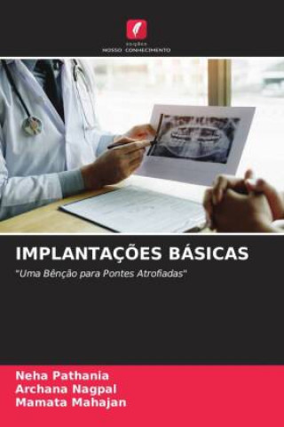 Книга IMPLANTAÇ?ES BÁSICAS Archana Nagpal