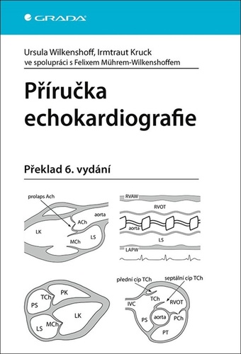 Книга Příručka echokardiografie Irmtraut Kruck