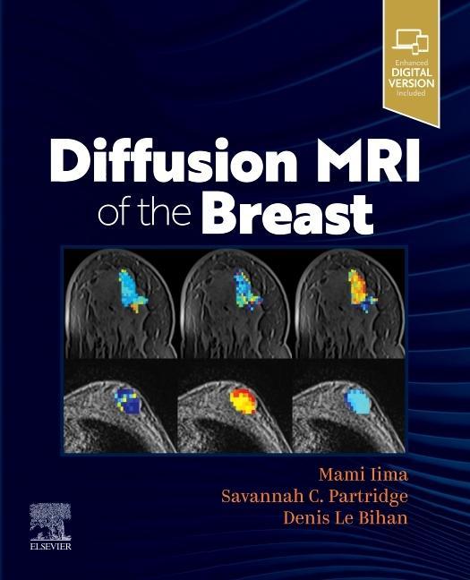 Könyv Diffusion MRI of the Breast Mami Iima