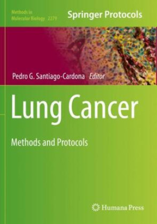 Knjiga Lung Cancer Pedro G. Santiago-Cardona