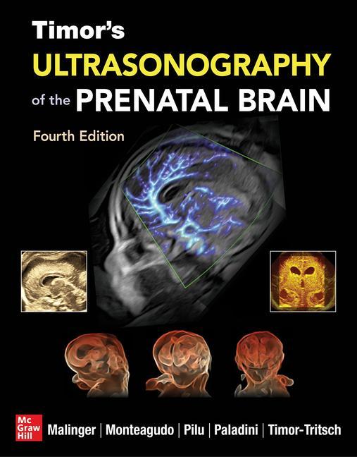 Carte Timor's Ultrasonography of the Prenatal Brain, Fourth Edition Ana Monteagudo