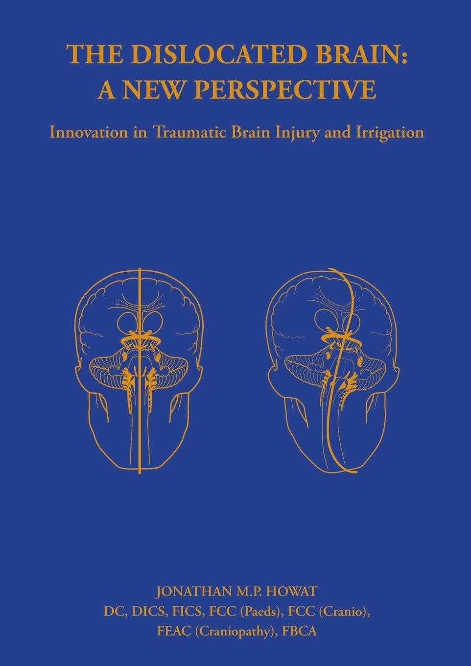 Book Dislocated Brain: A New Perspective Jonathan Howat