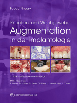 Könyv Knochen- und Weichgewebeaugmentation in der Implantologie 