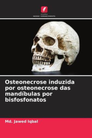 Kniha Osteonecrose induzida por osteonecrose das mandíbulas por bisfosfonatos 