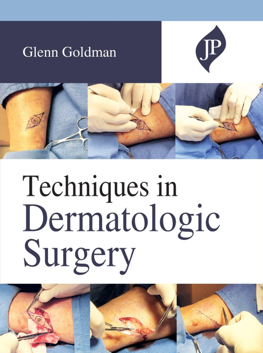 Knjiga Techniques in Dermatologic Surgery Glenn Goldman