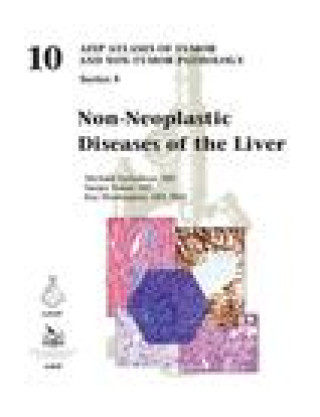 Carte Non-Neoplastic Diseases of the Liver Torbenson