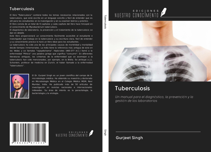Knjiga Tuberculosis 
