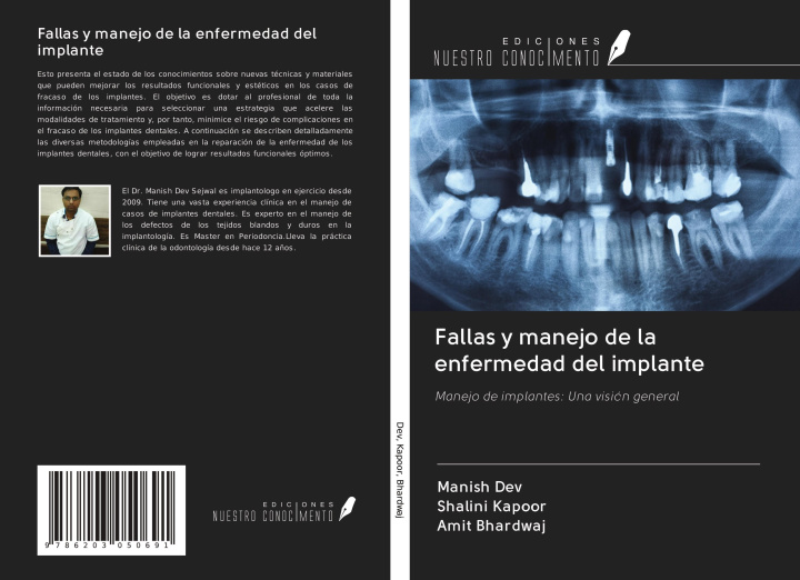 Knjiga Fallas y manejo de la enfermedad del implante Shalini Kapoor