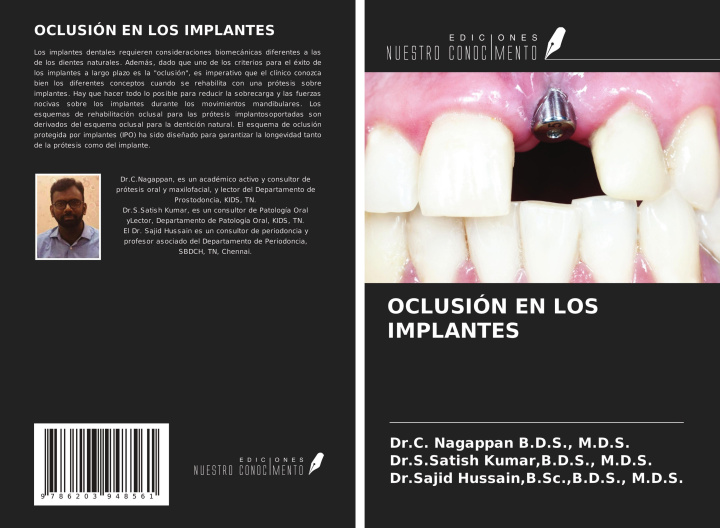 Knjiga OCLUSIÓN EN LOS IMPLANTES B. D. S. Kumar
