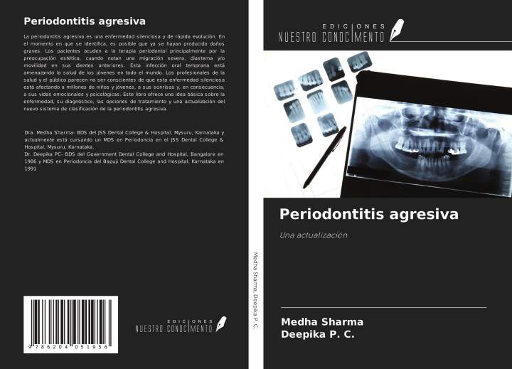 Knjiga Periodontitis agresiva Deepika P. C.