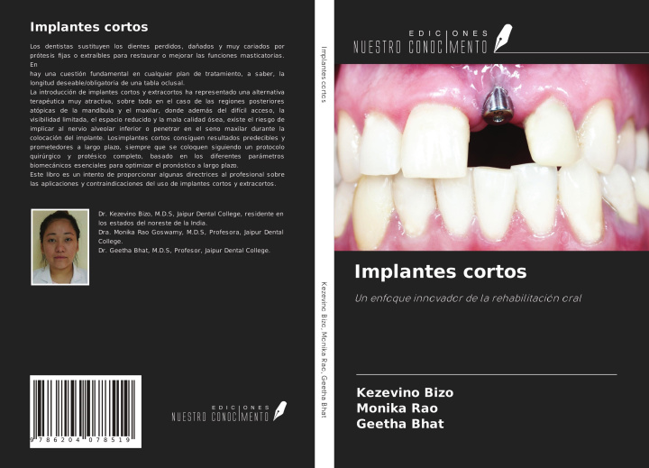Knjiga Implantes cortos Monika Rao