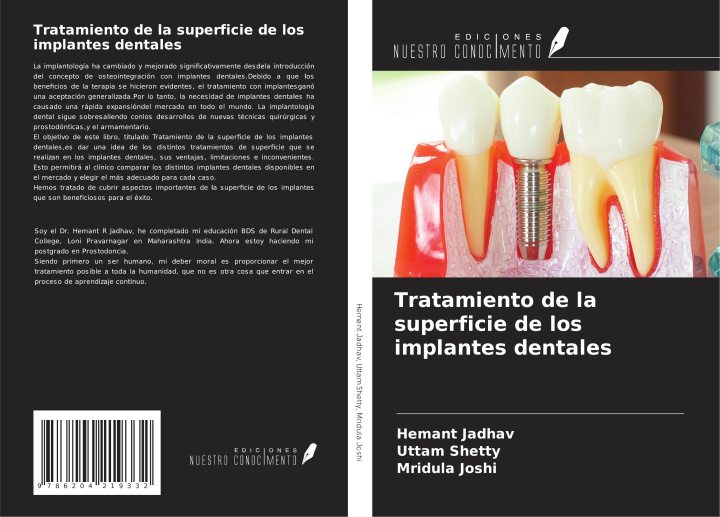 Boek Tratamiento de la superficie de los implantes dentales Uttam Shetty