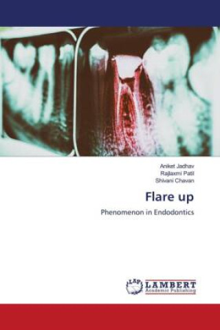 Kniha Flare up Rajlaxmi Patil