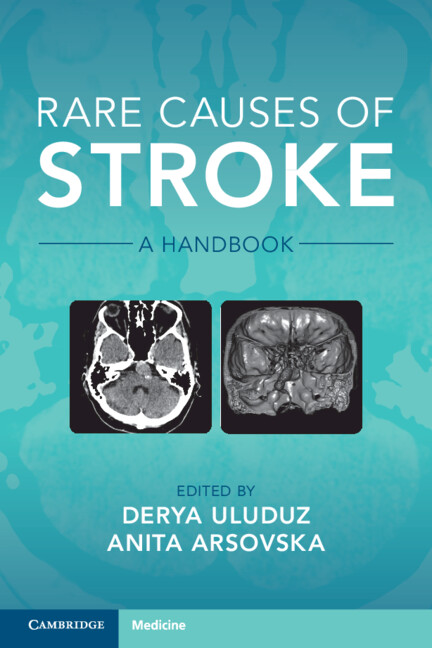 Kniha Rare Causes of Stroke Derya Uluduz