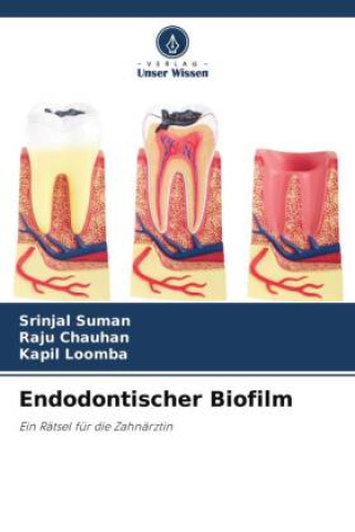 Kniha Endodontischer Biofilm Raju Chauhan