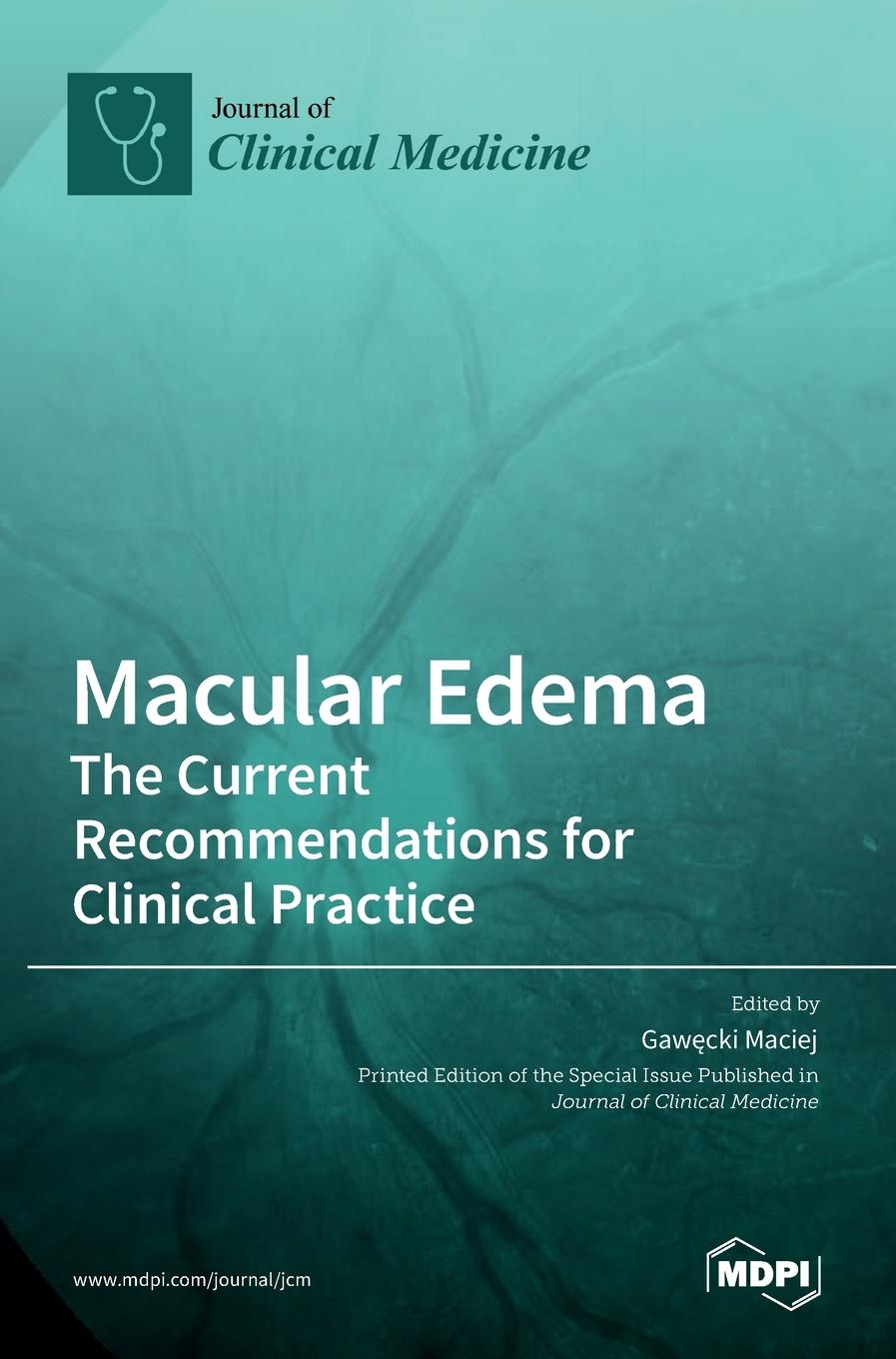 Knjiga Macular Edema Gawecki Maciej