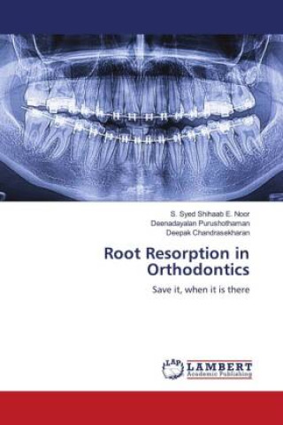 Kniha Root Resorption in Orthodontics Deenadayalan Purushothaman