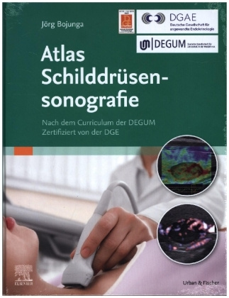 Carte Atlas Schilddrüsensonografie 