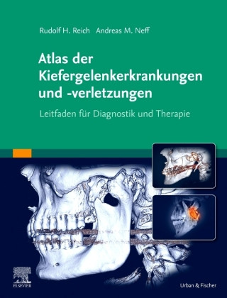 Könyv Atlas der Kiefergelenkerkrankungen und -verletzungen 