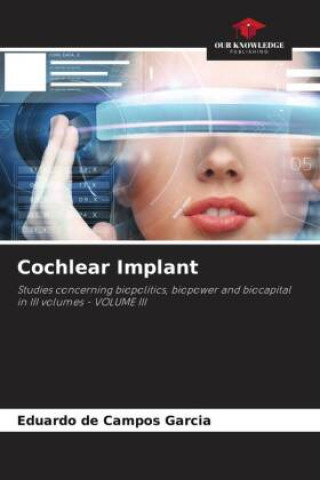 Knjiga Cochlear Implant Eduardo de Campos Garcia