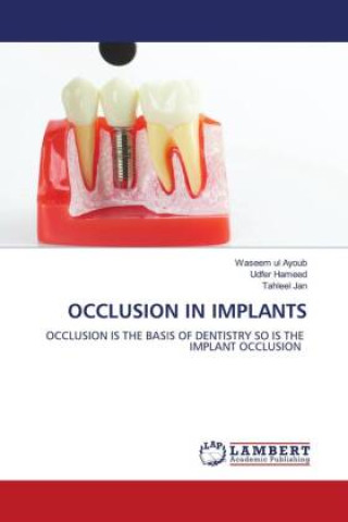 Knjiga OCCLUSION IN IMPLANTS Udfer Hameed