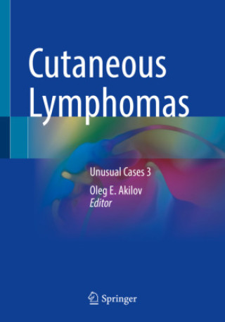 Knjiga Cutaneous Lymphomas Oleg E. Akilov