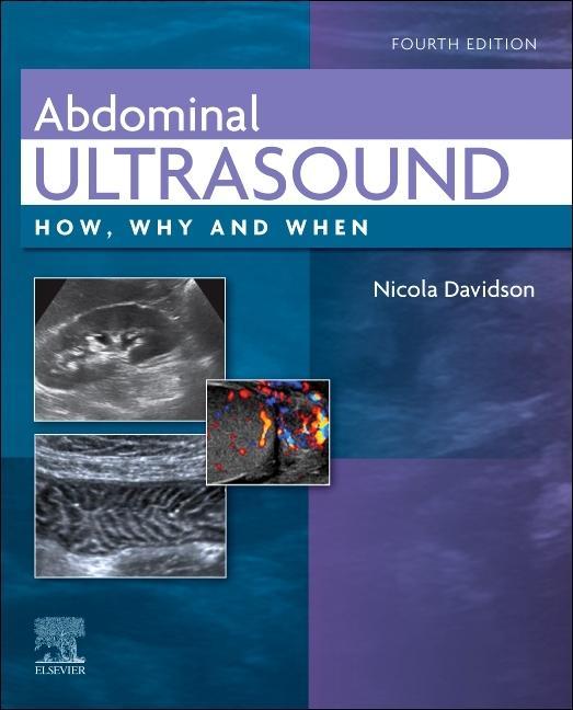 Book Abdominal Ultrasound Nicola Davidson