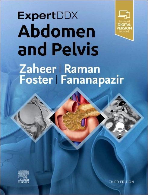 Kniha ExpertDDx: Abdomen and Pelvis Atif Zaheer