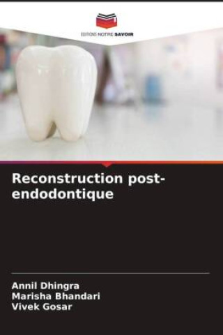 Buch Reconstruction post-endodontique Marisha Bhandari