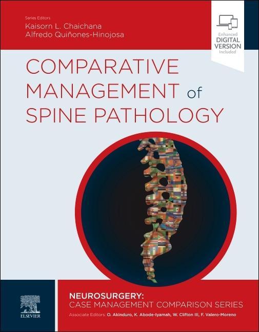 Kniha Comparative Management of Spine Pathology Kaisorn Chaichana