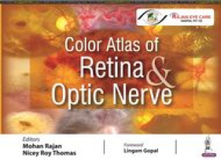 Könyv Color Atlas of Retina & Optic Nerve Nicey Roy Thomas