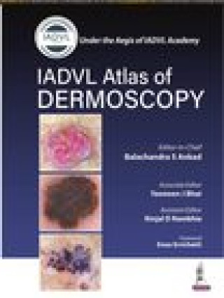 Книга Atlas of Dermoscopy Yasmeen J Bhat