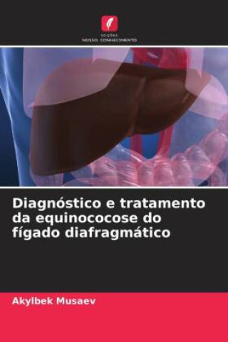 Boek Diagnóstico e tratamento da equinococose do fígado diafragmático Mictilbek Aintnazarov