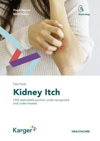 Книга Fast Facts: Kidney Itch Hugh Rayner