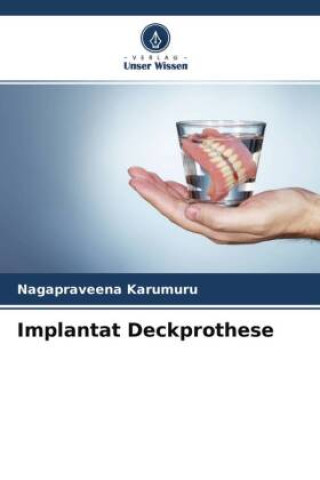 Könyv Implantat Deckprothese 