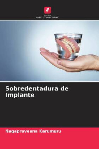 Boek Sobredentadura de Implante Nagapraveena Karumuru