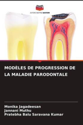 Boek MOD?LES DE PROGRESSION DE LA MALADIE PARODONTALE Jannani Muthu