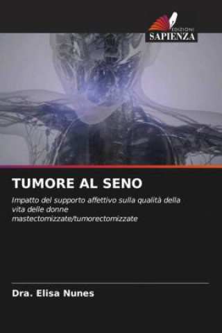 Knjiga TUMORE AL SENO Dra. Elisa Nunes