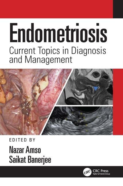 Carte Endometriosis 