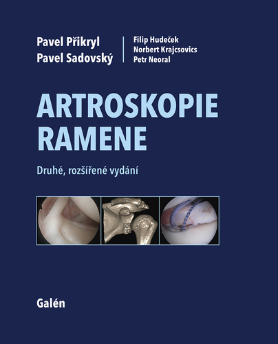 Kniha Artroskopie ramene Pavel Přikryl; Pavel Sadovský; Filip Hudeček; Norbert Krajcsovics; Petr Neoral