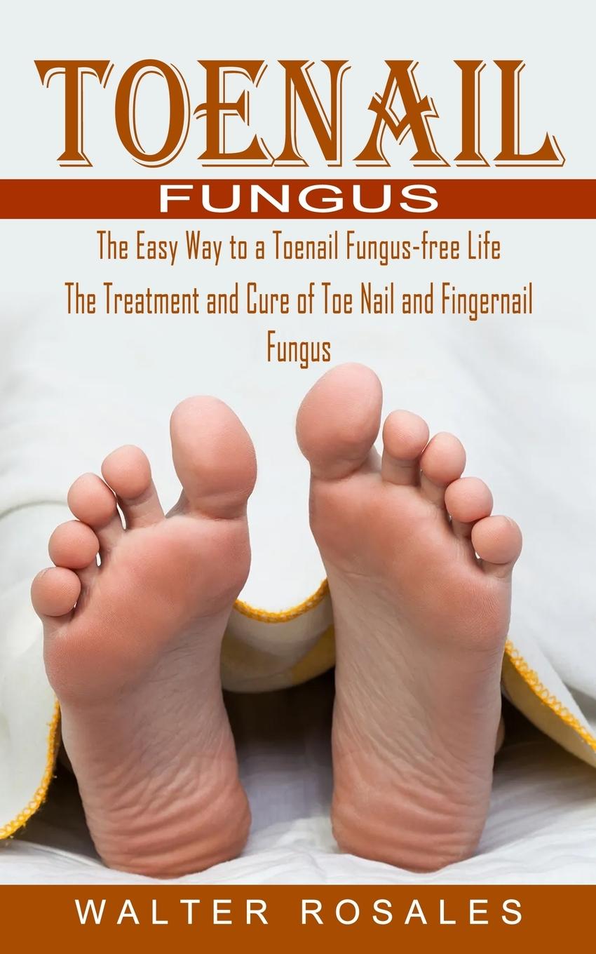 Книга Toenail Fungus 