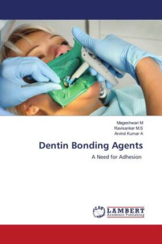 Knjiga Dentin Bonding Agents Ravisankar M. S