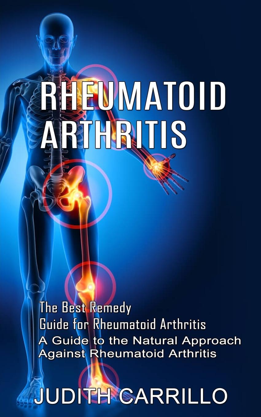Kniha Rheumatoid Arthritis 