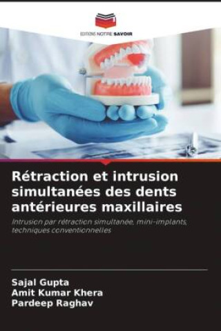 Libro Rétraction et intrusion simultanées des dents antérieures maxillaires Amit Kumar Khera