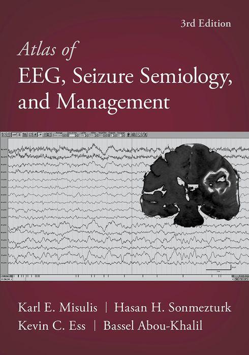 Kniha Atlas of EEG, Seizure Semiology, and Management Karl Edward Misulis