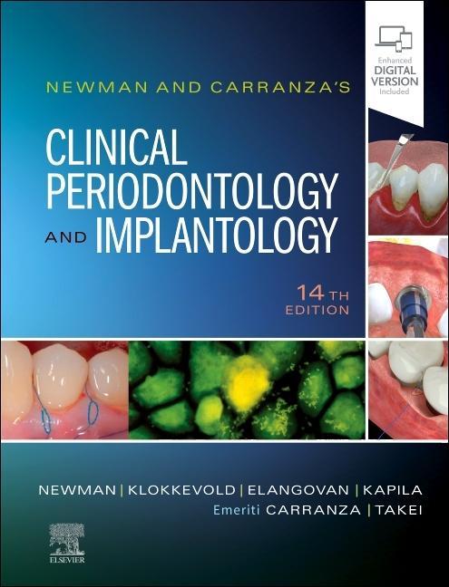Книга Newman and Carranza's Clinical Periodontology and Implantology Michael G. Newman