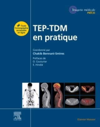 Книга TEP-TDM en pratique Chakib Bennani Smires