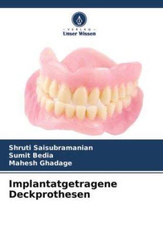Buch Implantatgetragene Deckprothesen Sumit Bedia